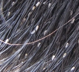 Çocuklarda Kepek Belirtileri ve Tedavisi